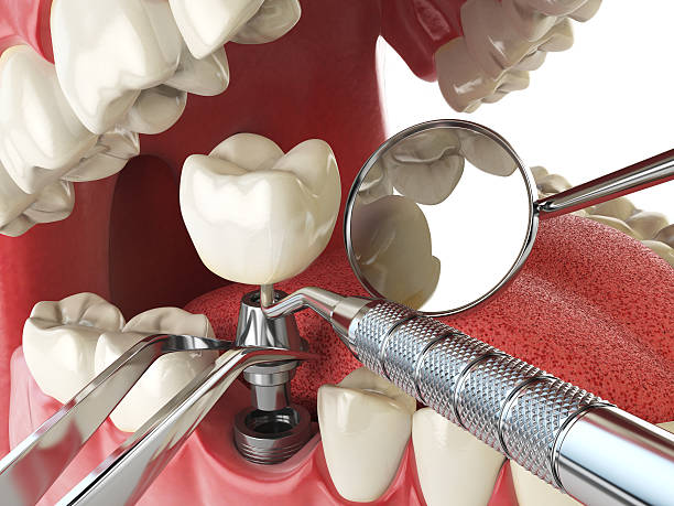 Best Weekend Emergency Dentist in Oak Grove, MO